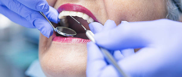 Best Emergency Treatment for Dental Infections or Abscesses in Lebanon, KY